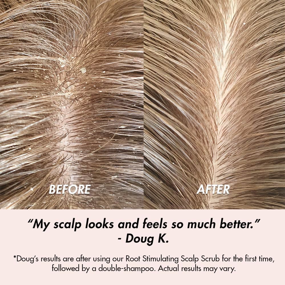 BEFORE-&-AFTER-Scalp-Scrub