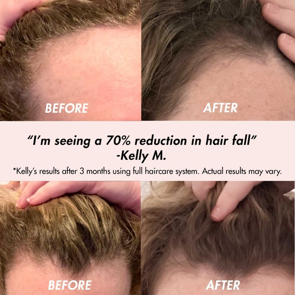 Caffeine C1 Anti Hair Loss Essential Oil 30ml | Shop Today. Get it  Tomorrow! | takealot.com